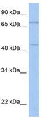 Immunoglobulin Superfamily Containing Leucine Rich Repeat 2 antibody, TA338443, Origene, Western Blot image 