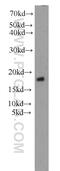 Signal Recognition Particle 14 antibody, 11528-1-AP, Proteintech Group, Western Blot image 