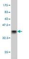 Spectrin Repeat Containing Nuclear Envelope Protein 2 antibody, ab57397, Abcam, Western Blot image 