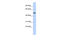 BTB Domain Containing 3 antibody, 25-198, ProSci, Western Blot image 