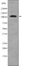 EPH Receptor A1 antibody, abx215179, Abbexa, Western Blot image 