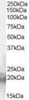 CCHC-Type Zinc Finger Nucleic Acid Binding Protein antibody, GTX89380, GeneTex, Western Blot image 