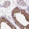 Translin antibody, PA5-63747, Invitrogen Antibodies, Immunohistochemistry paraffin image 