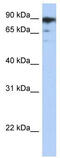 RB Associated KRAB Zinc Finger antibody, TA331801, Origene, Western Blot image 