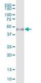 Wilms tumor protein 1-interacting protein antibody, H00126374-B01P, Novus Biologicals, Western Blot image 