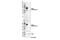Interferon Gamma Receptor 1 antibody, 10405S, Cell Signaling Technology, Western Blot image 