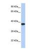 Dmrt7 antibody, NBP1-80128, Novus Biologicals, Western Blot image 