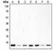 Cyclin Dependent Kinase Inhibitor 2A antibody, LS-C351999, Lifespan Biosciences, Western Blot image 