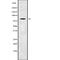 Transmembrane Channel Like 7 antibody, abx219115, Abbexa, Western Blot image 