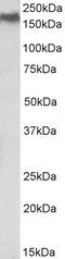 NPC Intracellular Cholesterol Transporter 1 antibody, 43-348, ProSci, Western Blot image 