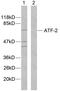 Activating Transcription Factor 2 antibody, LS-C118049, Lifespan Biosciences, Western Blot image 