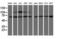 Proteasome 26S Subunit, Non-ATPase 3 antibody, M08767-1, Boster Biological Technology, Western Blot image 