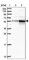 Cyclase Associated Actin Cytoskeleton Regulatory Protein 2 antibody, NBP2-30572, Novus Biologicals, Western Blot image 