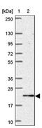 Katanin Regulatory Subunit B1 Like 1 antibody, PA5-64034, Invitrogen Antibodies, Western Blot image 