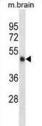 Calcium/Calmodulin Dependent Protein Kinase II Alpha antibody, abx028302, Abbexa, Western Blot image 