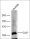 Cartilage Intermediate Layer Protein antibody, orb182643, Biorbyt, Western Blot image 