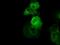 Bruton Tyrosine Kinase antibody, NBP2-02472, Novus Biologicals, Immunofluorescence image 