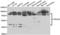 Trimethyllysine Hydroxylase, Epsilon antibody, LS-C346354, Lifespan Biosciences, Western Blot image 