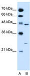 Retinoic acid receptor RXR-gamma antibody, TA338120, Origene, Western Blot image 