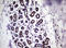 Nibrin antibody, LS-C175640, Lifespan Biosciences, Immunohistochemistry paraffin image 