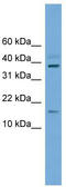 Atonal BHLH Transcription Factor 7 antibody, TA342322, Origene, Western Blot image 