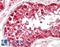 Damage Specific DNA Binding Protein 1 antibody, LS-B11164, Lifespan Biosciences, Immunohistochemistry paraffin image 