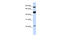 Mannosyl-Oligosaccharide Glucosidase antibody, 26-154, ProSci, Western Blot image 
