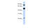 Mannosyl-oligosaccharide glucosidase antibody, 26-154, ProSci, Western Blot image 