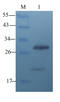 TIMP Metallopeptidase Inhibitor 1 antibody, orb11483, Biorbyt, Western Blot image 