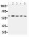 Growth Factor Receptor Bound Protein 7 antibody, PA1589-1, Boster Biological Technology, Western Blot image 