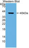 LDL Receptor Related Protein 1 antibody, LS-C314678, Lifespan Biosciences, Western Blot image 