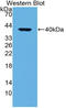 APR antibody, LS-C314678, Lifespan Biosciences, Western Blot image 