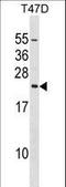 Eukaryotic Translation Initiation Factor 3 Subunit K antibody, LS-C167692, Lifespan Biosciences, Western Blot image 