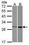 Methenyltetrahydrofolate Synthetase antibody, PA5-30565, Invitrogen Antibodies, Western Blot image 