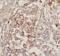 Polymorphic epithelial mucin antibody, FNab05427, FineTest, Immunohistochemistry paraffin image 