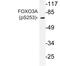 Forkhead Box O3 antibody, LS-C178088, Lifespan Biosciences, Western Blot image 