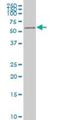 AKT Serine/Threonine Kinase 2 antibody, H00000208-M05, Novus Biologicals, Western Blot image 