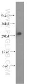 Acidic Nuclear Phosphoprotein 32 Family Member A antibody, 15810-1-AP, Proteintech Group, Western Blot image 