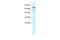 Ras And Rab Interactor 3 antibody, 28-145, ProSci, Western Blot image 