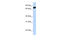 Leucine Rich Repeats And Calponin Homology Domain Containing 4 antibody, ARP45267_P050, Aviva Systems Biology, Western Blot image 