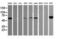 DIX Domain Containing 1 antibody, M05992, Boster Biological Technology, Western Blot image 