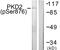 Protein Kinase D2 antibody, LS-C199466, Lifespan Biosciences, Western Blot image 