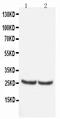 TIMP Metallopeptidase Inhibitor 4 antibody, PA1078, Boster Biological Technology, Western Blot image 