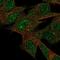 Leucine Rich Repeat Neuronal 3 antibody, NBP2-30614, Novus Biologicals, Immunocytochemistry image 
