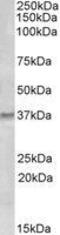 GTP Cyclohydrolase 1 antibody, GTX88689, GeneTex, Western Blot image 