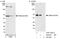 Transforming Growth Factor Beta Regulator 4 antibody, A301-392A, Bethyl Labs, Immunoprecipitation image 