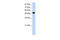 NOVA Alternative Splicing Regulator 2 antibody, 29-289, ProSci, Western Blot image 