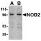 Nucleotide Binding Oligomerization Domain Containing 2 antibody, PA5-19992, Invitrogen Antibodies, Western Blot image 