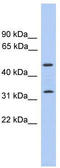 Tumor Protein P63 Regulated 1 antibody, TA333368, Origene, Western Blot image 