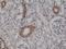 Actin Alpha 2, Smooth Muscle antibody, M01072-4, Boster Biological Technology, Immunohistochemistry paraffin image 